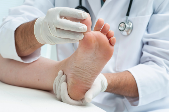 Podiatrist in Los Angeles, Foot doctor in Los Angeles